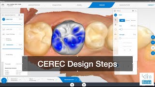 CEREC Software 5 Step Design Workflow [upl. by Bent815]