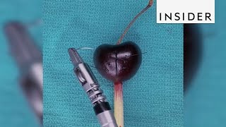 The FlexDex mechanical arm could revolutionize surgery [upl. by Nahtanhoj480]