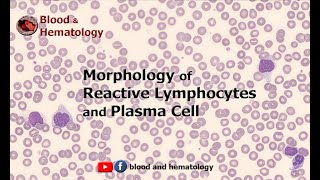 Morphology of Reactive Lymphocytes and Plasma Cell [upl. by Thorr]