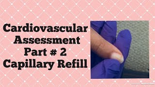 Cardiovascular Assessment Part Two  Capillary Refill Test [upl. by Swane]