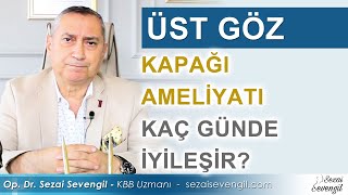 Üst Göz Kapağı Ameliyatı Kaç Günde İyileşir  Op Dr Sezai Sevengil  KBB Uzmanı [upl. by Saideman]