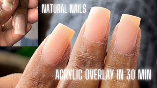 HOW TO ACRYLIC OVERLAY IN 30 MIN OR LESS  SHORT OVERLAY ON NATURAL NAILS  Chit Chat [upl. by Cilka912]