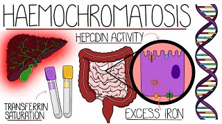 Understanding Haemochromatosis Hereditary amp Secondary [upl. by Trish819]