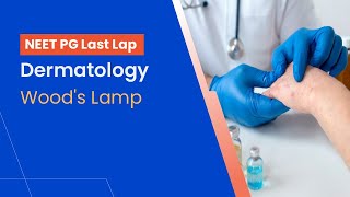 NEETPG Prep  Dermatology  Woods Lamp by Dr Shimona [upl. by Dhumma72]