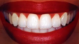 Teeth Whitening At Home In 3 Minutes  How To Whiten Your Yellow Teeth Naturally  100 Effective [upl. by Stronski]