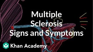 Multiple sclerosis signs and symptoms  Nervous system diseases  NCLEXRN  Khan Academy [upl. by Hodge664]