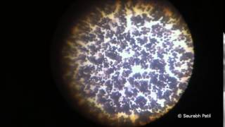 Candida albicans growth on Sabouraud agar [upl. by Ycnaffit404]