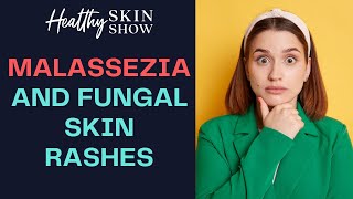 Malassezia And FUNGAL Skin Problems  Dr Julie Greenberg [upl. by Dowzall]