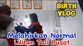 Melahirkan Normal Lilitan Tali Pusat birthvlog [upl. by Liarret]