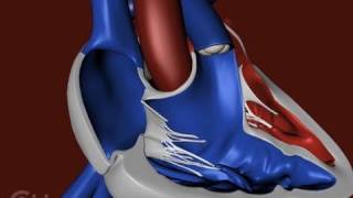 The Structure of a Heart with Tetralogy of Fallot TOF  The Childrens Hospital of Philadelphia [upl. by Ephram284]