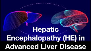 Hepatic Encephalopathy HE in Advanced Liver Disease [upl. by Annua]