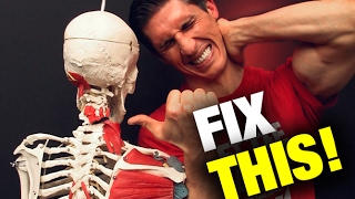 How to Fix a Stiff Neck in Seconds THIS WORKS [upl. by Yslek]