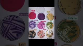 Gram Positive nd Negative Bacteria urineanalysis clinicalpathology microbiologylab ytshortsvideo [upl. by Maryann]