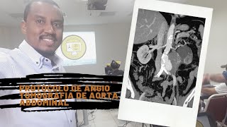 PROTOCOLO DE ANGIOTOMOGRAFIA DE AORTA ABDOMINAL  DIEGO CESAR [upl. by Nortad329]