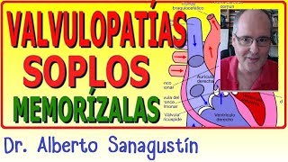 Memoriza las VALVULOPATÍAS y SOPLOS ✅ rápido y fácil [upl. by Corydon]