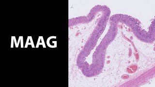 Maag wat een fraai epitheel De histologiemicroscopie van de maag [upl. by Melessa]