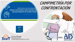 Método de Campimetría por Confrontación [upl. by Notxam]