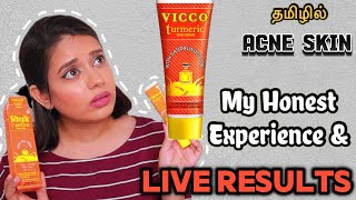 I TRIED VICCO CREAM FOR A WEEK ON ACNE SKIN AND THIS HAPPENED  Vicco Turmeric cream Review in Tamil [upl. by Noram]