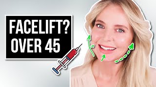 My Secret To Looking 10 Years Younger and Lifting My Skin Over 45 Threadlifts Ultherapy Filler [upl. by Katya]