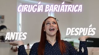 Como cambia la vida antes y después de la Cirugia Bariatrica [upl. by Cirek871]