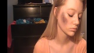 How To Make a FAKE bruise with only eyeshadow [upl. by Marti]