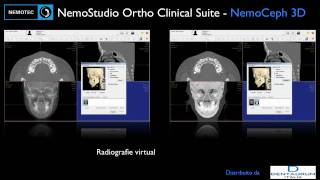 NemoStudio Ortho Clinical Suite [upl. by Anallese727]