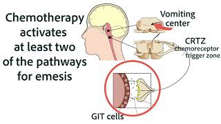 Antiemetics for Chemotherapy and GIT Origins [upl. by Humble]