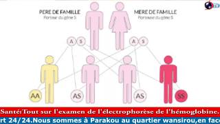 SANTÉ Tout sur lexamen de lélectrophorèse de lhémoglobine [upl. by Omero]