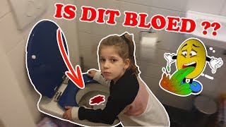 quotMAMA IK HEB BLOED GESPUUGDquot KOETLIFE VLOG [upl. by Bac]