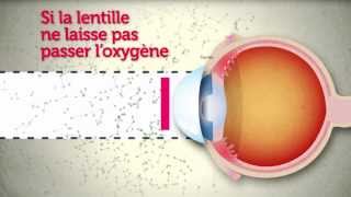 Lentilles de contact  attention les yeux [upl. by Sivart]