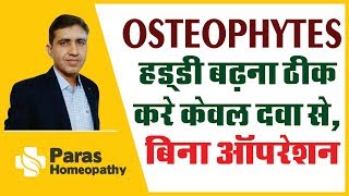 Osteophytes  हड्डी बढ़ने का कारण  Bone Spur  हड्डी बढ़ना ठीक करे केवल दवा से बिना ऑपरेशन इलाज [upl. by Yekciv]