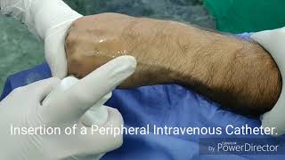 Insertion of a Peripheral Intravenous Catheter [upl. by Nivlad]