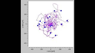 Myosin 6 in breast cancer cells – Video S1 479151 [upl. by Irik154]