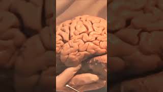 Who stole Einsteins Brain 🧠  Most Amazing Facts  Mind Blowing Facts science ytshorts [upl. by Saihttam]