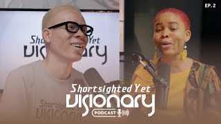 Understanding Albinism  SYV PodcastS1EP2  Ft Jessica Hyacinth [upl. by Ogeid]