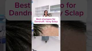 Right way to apply anti dandruff shampoo  part i  treatment of dandruff haircare DrMigraine [upl. by Yreneh]