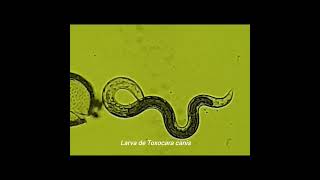 Larva de Toxocara canis [upl. by Naujd]