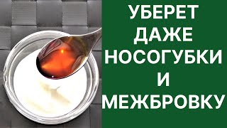 Уберёт Даже Межбровку и Носогубки Бомба от Морщин Рецепт [upl. by Natsuj]