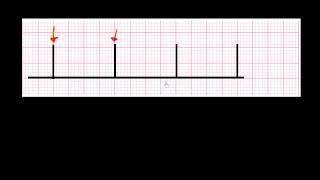 CURSO DE ELECTROCARDIOGRAFIA 11  MEDICIÓN DE LA FRECUENCIA DE UN EVENTO [upl. by Toni]