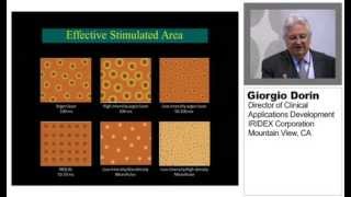 How To Determine MicroPulse Laser Parameters for SubVisibleThreshold Treatments [upl. by Hakeem]