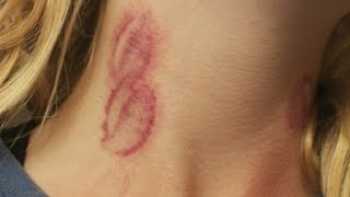 how to give yourself a hickey on your neck with your hands easy [upl. by Ogdon]