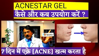 Acnestar creamकब और कैसे लगाना चाहिए  AcneStar Gel Review Acnestar gel Price Uses amp Side Effect [upl. by Niboc]