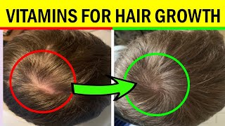 10 Best Vitamins and Supplements for Hair Growth  Grow THIN Hair into THICK Hair [upl. by Nalani]