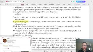 Гистопатологи 4  Nuclear atypia Бөөмийн хэв шинжгүйдэл эсвэл хэв шинжит бус байдал [upl. by Beebe]
