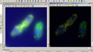 Image Deconvolution with AutoQuant Software [upl. by Nevetse]