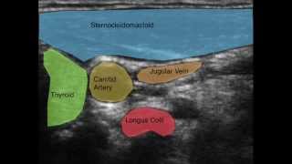 Ultrasound of the Deep Cervical Neck Flexors [upl. by Lajet]