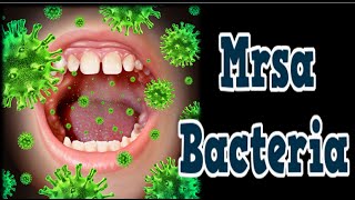 Mrsa Bacteria Antibiotic For Mrsa Mrsa Nares Treatment Mrsa Mrsa Signs And Symptoms [upl. by Marjy]