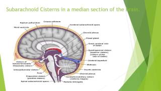 Subarachnoid Cisterns – Anatomy [upl. by Nosnibor]