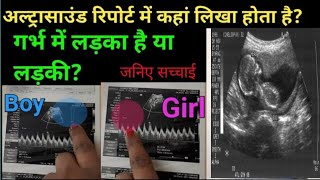 Ultrasound se jane Ladka ya ladki baby boy symptoms during pregnancy symptoms of baby boy babygender [upl. by Eelyek]