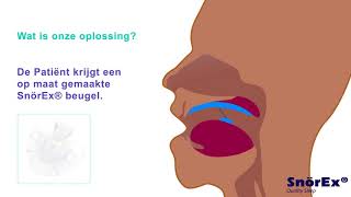 Oplossing tegen snurken [upl. by Sabu717]